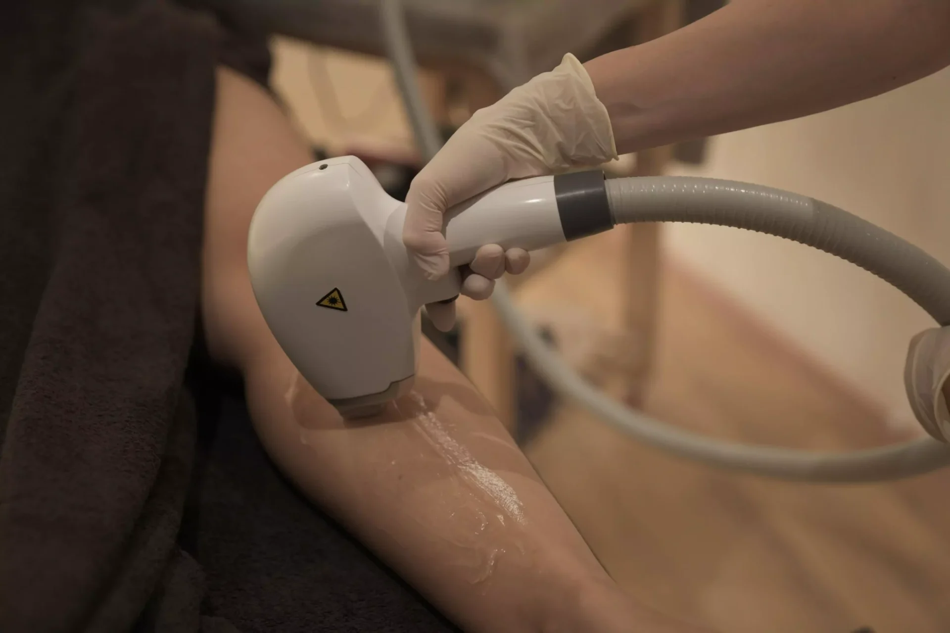 Depilazione Laser